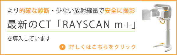 コーンビームCT「RAYSCAN m+」について